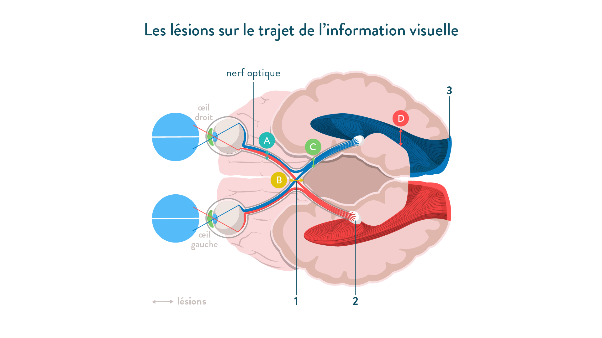 Nerf optique lésions-trajet information visuelle-sciences-1ère-es-l