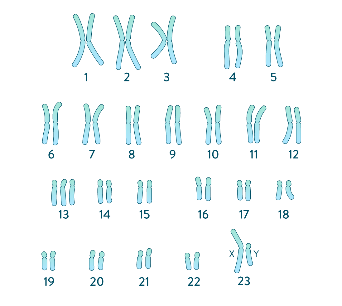 Caryotype-syndrome de Patau-svt-cycle4-schoolmouv