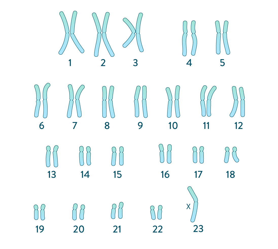 Caryotype-syndrome de Turner-svt-cycle4-schoolmouv